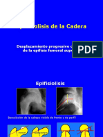 09-epifisiolisisdecadera-101005215408-phpapp01.ppt