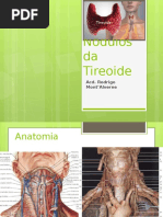 Nódulos Da Tireoide - Rodrigo Mont'Alverne