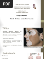 Vitiligo y Melasma