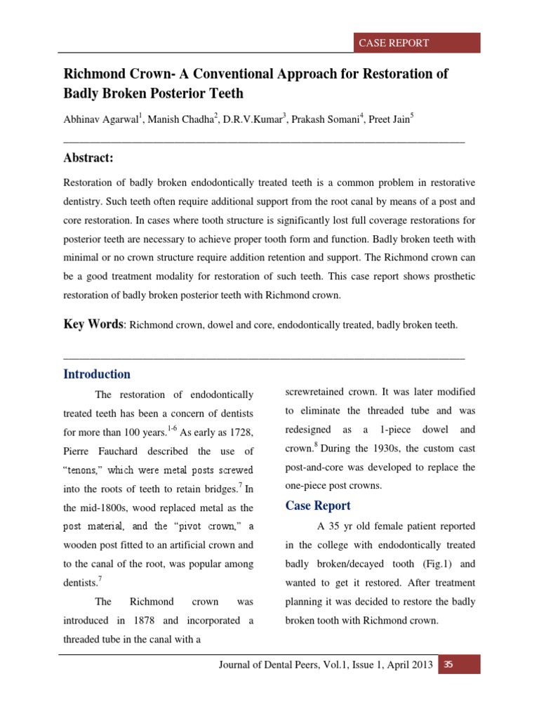 Richmond Crown | Dentistry | Mouth
