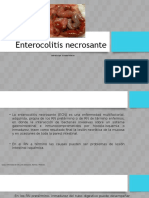 Enterocolitis necrosante
