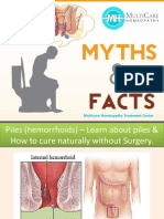 Piles (Hemorrhoids) – Learn About #Piles & How to Cure Naturally Without Surgery.