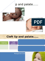 Cleft lip and palate treatment guide