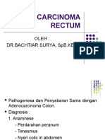 Adeno Carcinoma Rectum