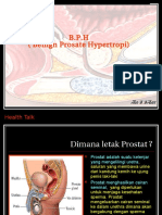 materi tentang tumor prostat