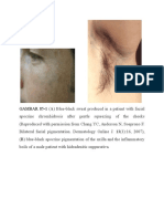 Sweat Gland Disorders and Pigmentation Changes