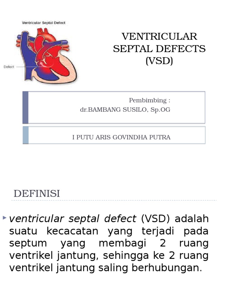 Ventricular Septal Defects 3 | PDF