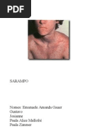 sarampo