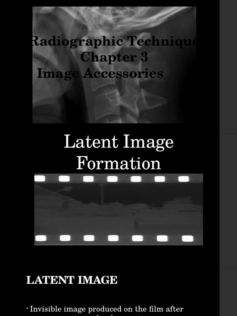 Radtechnique Report1 | PDF | Electromagnetic Radiation | Physics