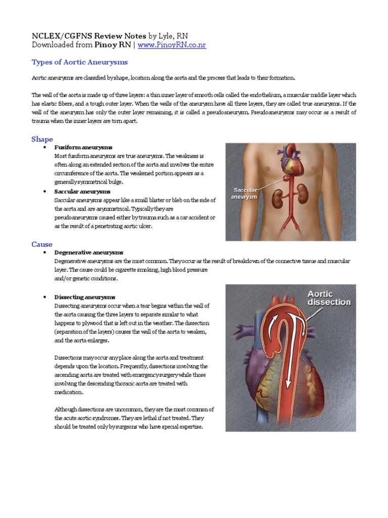 Review Notes for NCLEX CGFNS Aortic Aneurysms Aorta Thorax