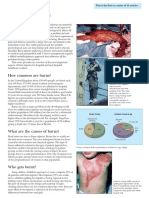 ABC of Burns pdf-37