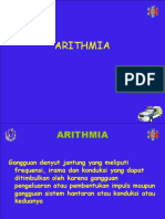 Arithmia