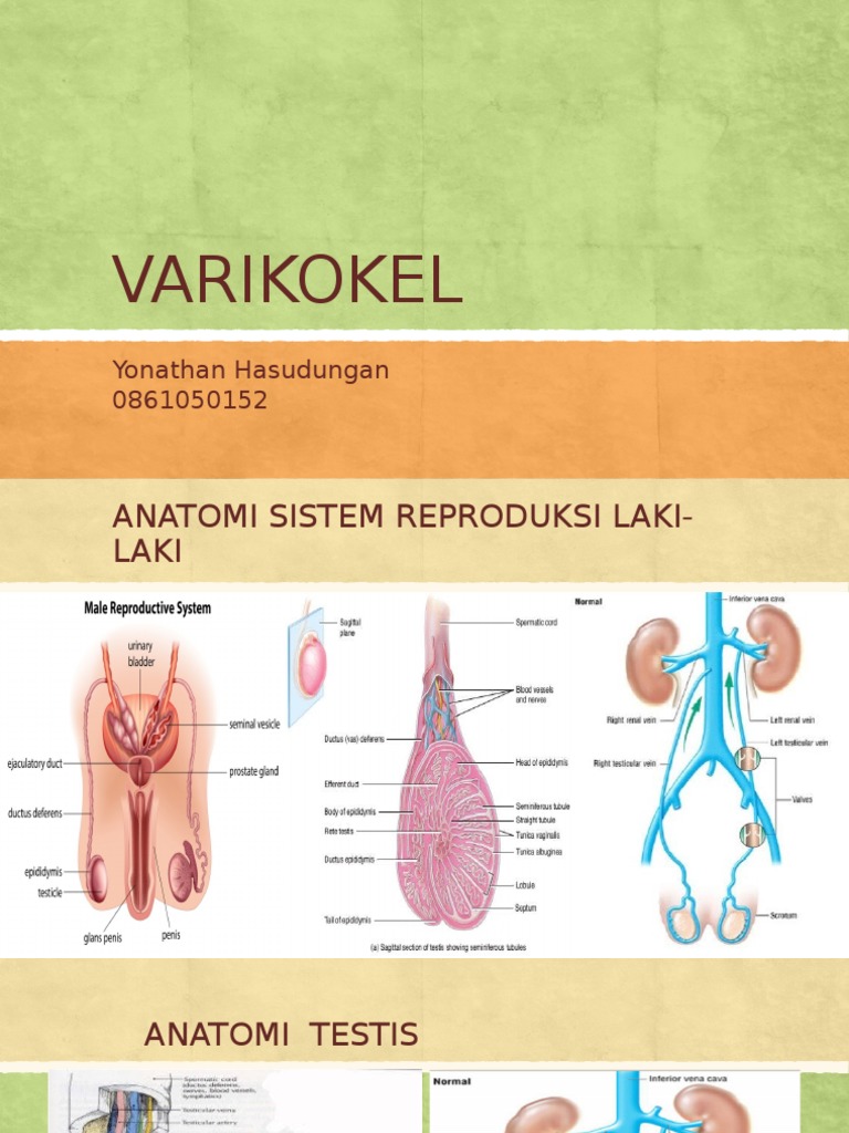 Varikokel   Varikokel