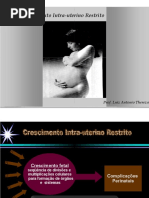 crescimento-intrauterino-retardado