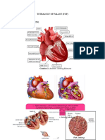 Anatomi Jantung Dan Tetralogy of Fallot