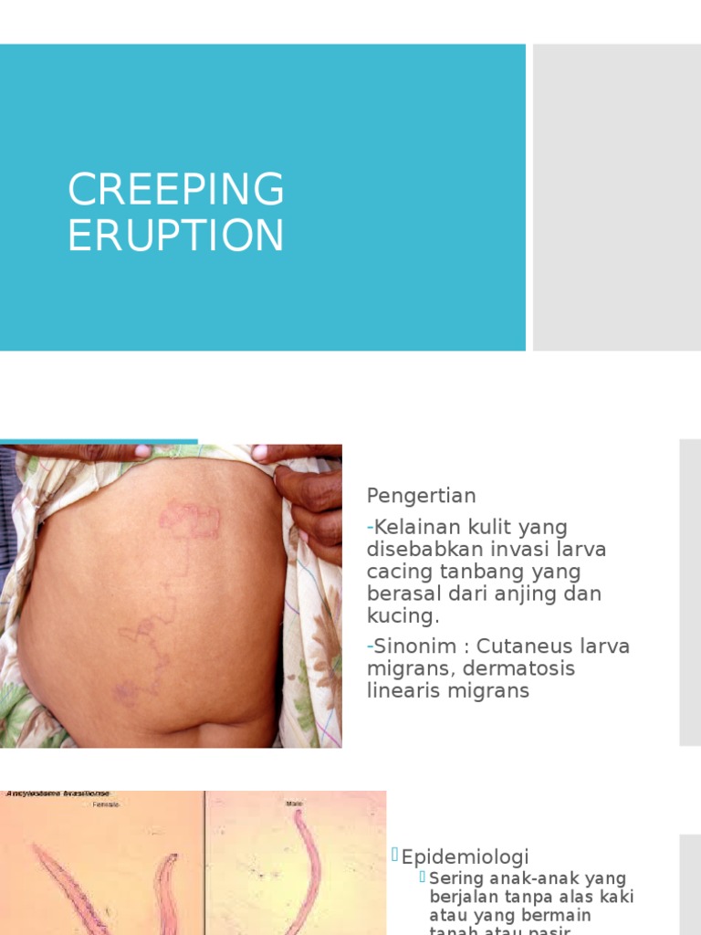 Creeping Eruption | PDF