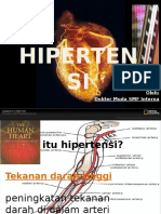 Hipertensi