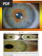 Iridologia Ojos