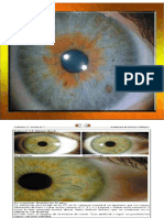 Iridologia Ojos