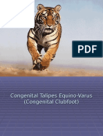 Congenital Talipes Equino-Varus