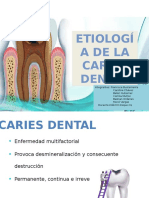 Etiologia Caries