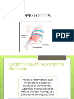 epiglotitis.pptx