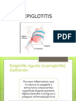 Epiglotitis