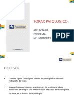 Patrones Torácicos: Atelectasia, Neumotórax, Enfisema