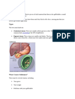 What Are Gallstones