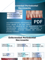 Enfermedad Periodontal Necrosante