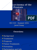 Adenocarcinoma of the Prostate.ppt