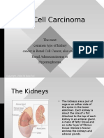 Renal Cell Carcinoma.ppt