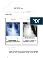 Tambahan Tugas Pneumoni Dan Atelektasis