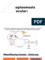 Toxoplasmosis ocular: causas, síntomas y tratamiento