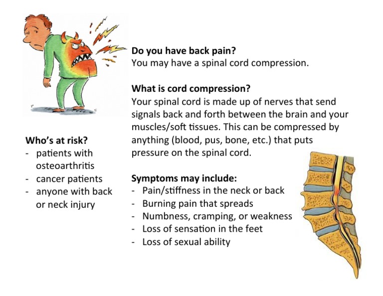 Do You Have Back Pain? What Is Cord Compression? | PDF | Science ...