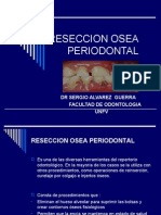 Reseccion Osea Periodontal