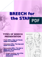 Breech