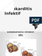 DT 5 Endokarditis Infektif DT