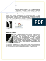 Tipos de viruta: continua, borde acumulado y discontinua