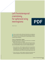 Left Frontolateral Craniotomi