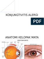 Konjungtivitis Alergi