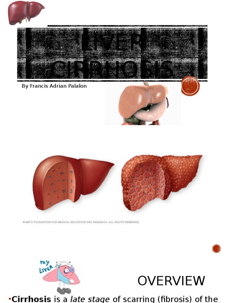 ANATOMY AND PHYSIOLOGY OF LIVER CIRRHOSIS SLIDESHARE visual data 3