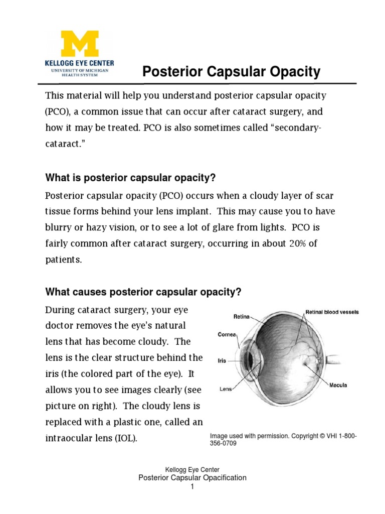 Posterior Capsular Opacity Surgery Clinical Medicine