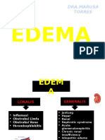 Edema 130706211220 Phpapp02