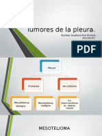 Tumores de La Pleura