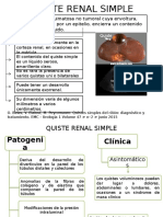 Quiste Renal Simple