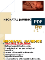 Jaundice-Neonatal 2016