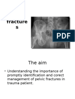 Understanding and Managing Pelvic Fractures