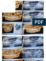 Estructuras Radiograficas Imagenes