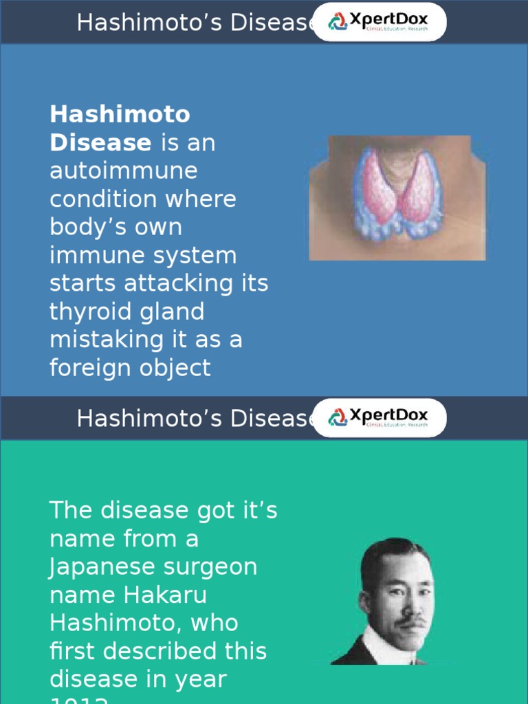 Hashimoto Disease - Complete Guide | PDF